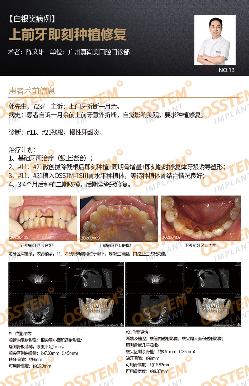 【白银奖病例】上前牙即刻种植修复-Dr_01.jpg