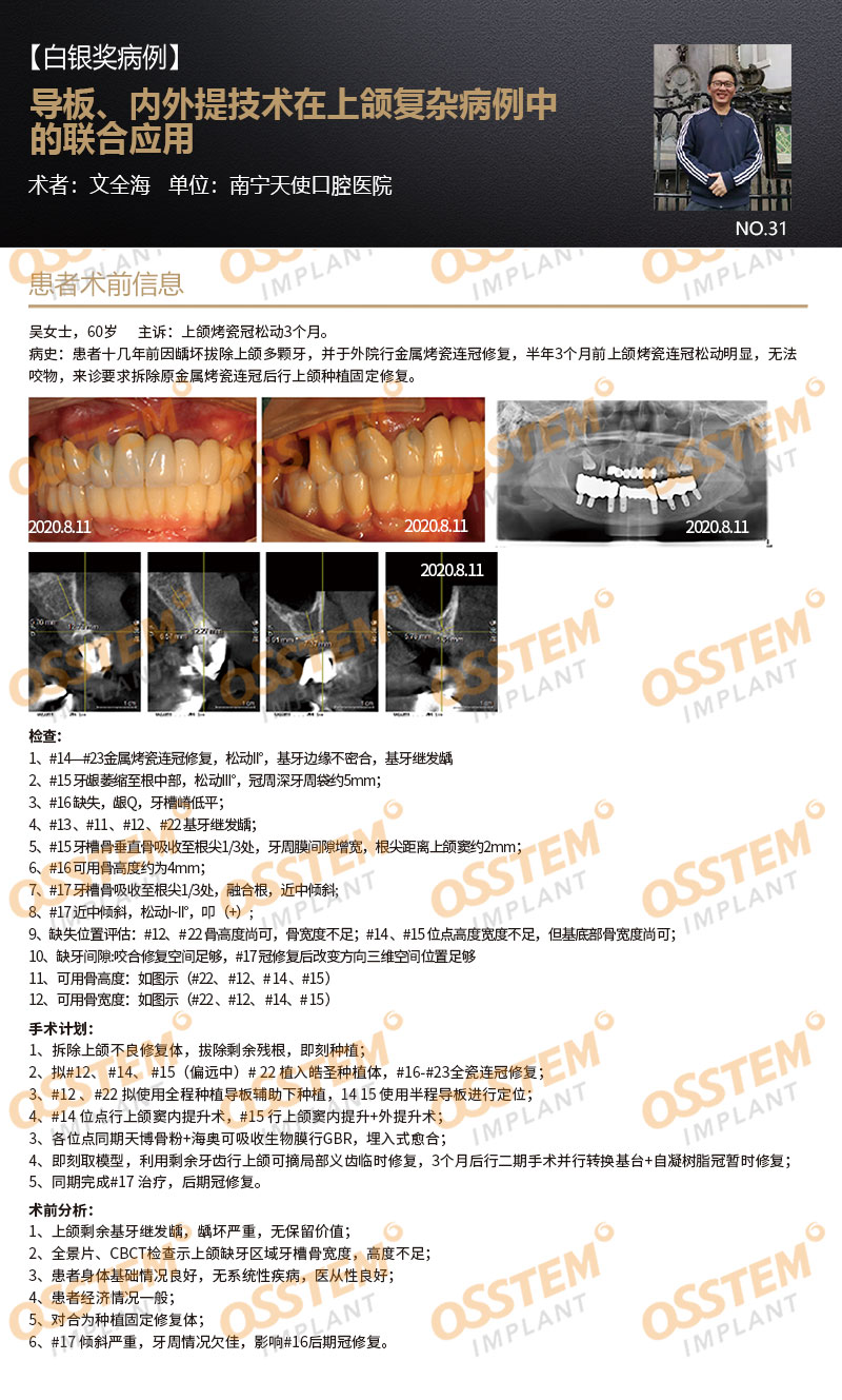 【白银奖病例】导板、内外提技术在上颌复杂病例中的联合应用-Dr_01.jpg