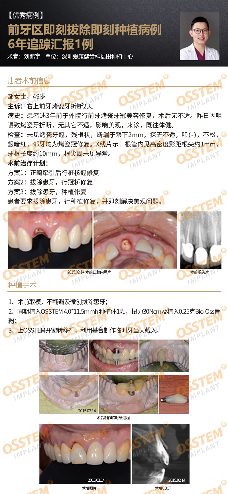 前牙区即刻拔除即刻种植病例6年追踪汇报1例-Dr_01.jpg