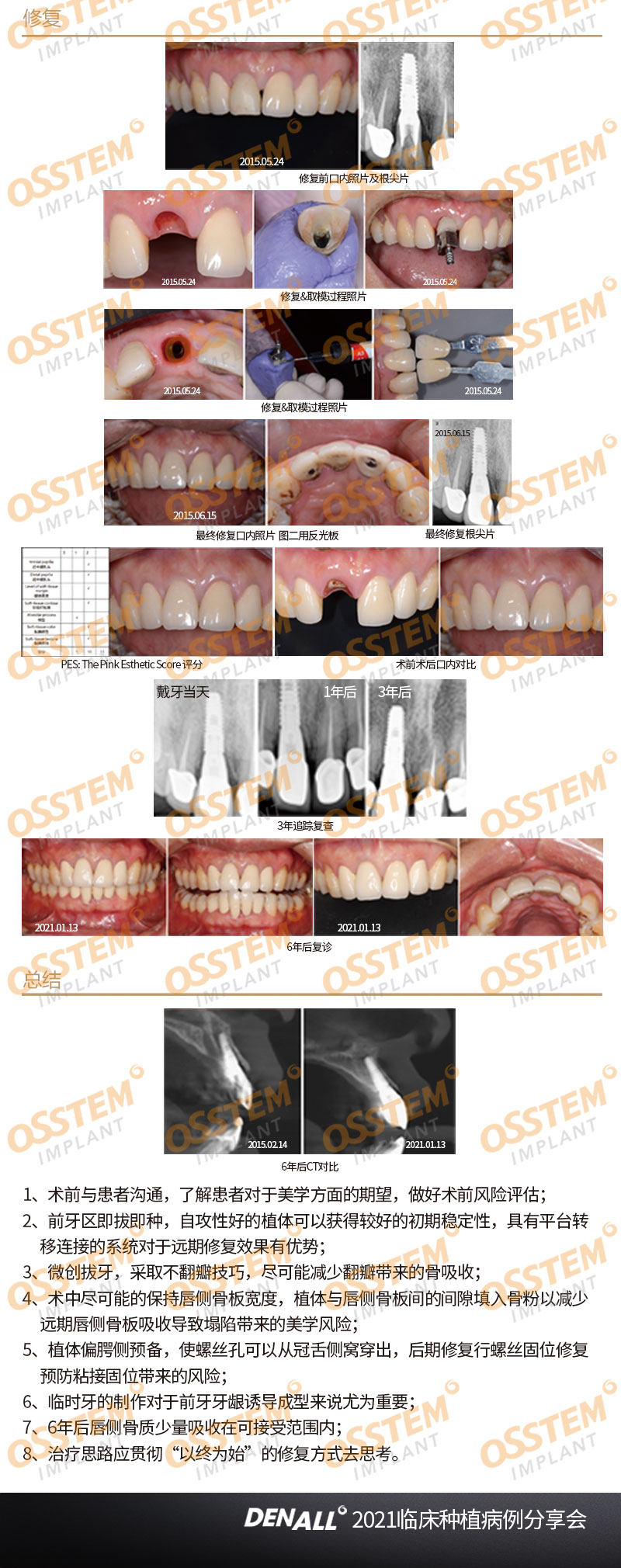 前牙区即刻拔除即刻种植病例6年追踪汇报1例-Dr_02.jpg