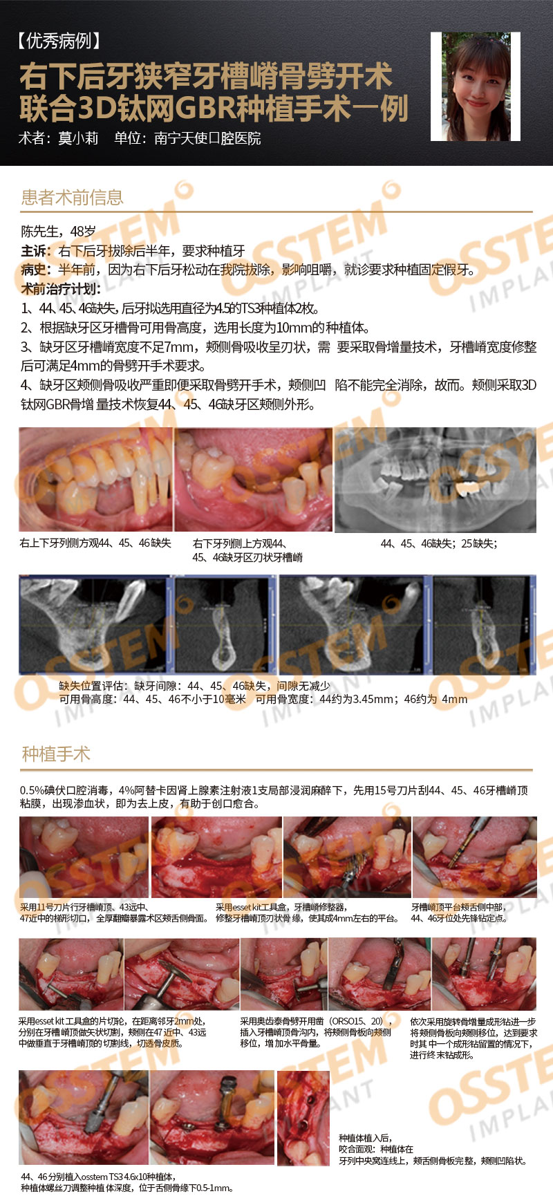 【优秀病例】右下后牙狭窄牙槽嵴⻣劈开术联合3D钛网GBR种植手术1例-Dr_01.jpg