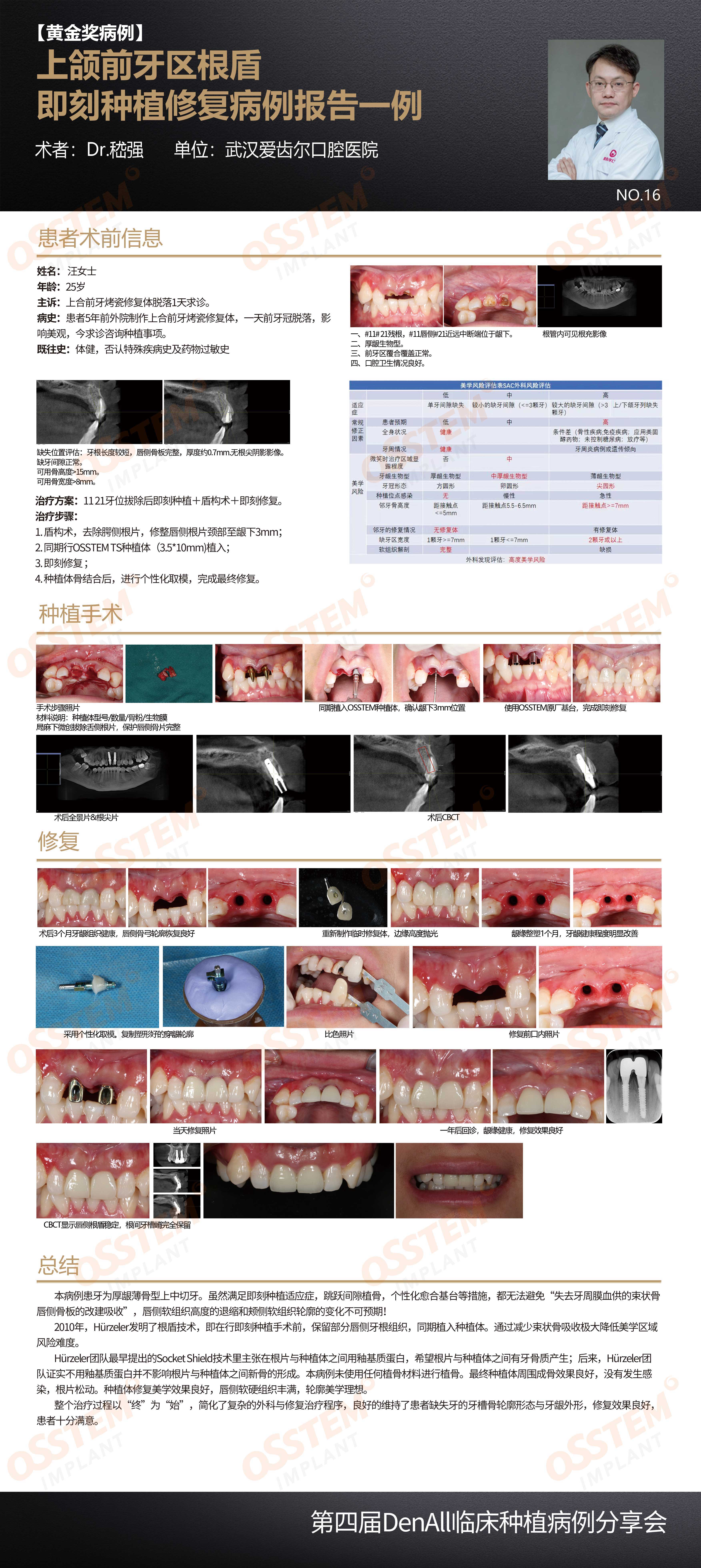 16-上颌前牙区根盾即刻种植修复病例报告一例-嵇强.jpg