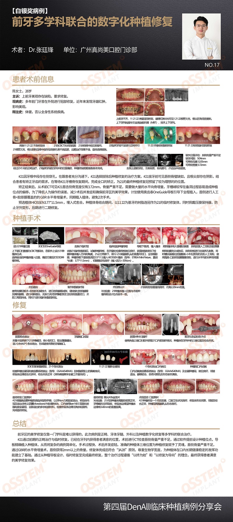 17--前牙多学科联合的数字化种植修复-张廷锋.jpg