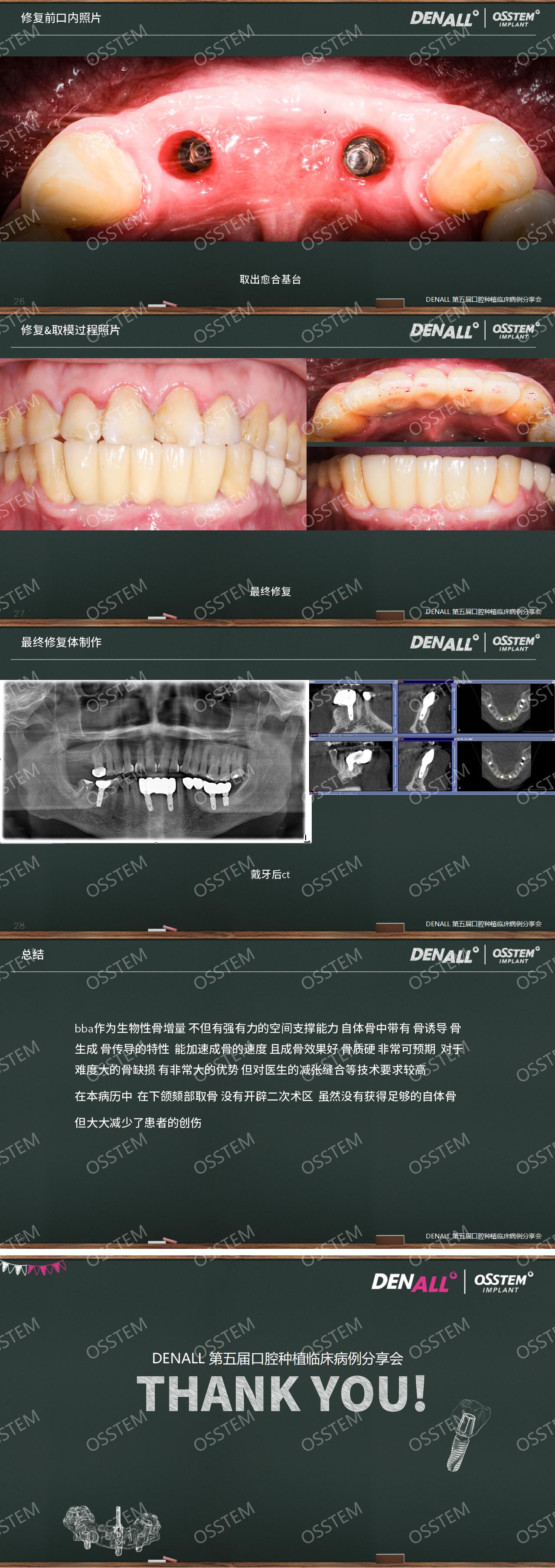 05-移花接木：下颌前牙区BBA的重建之路_02.jpg