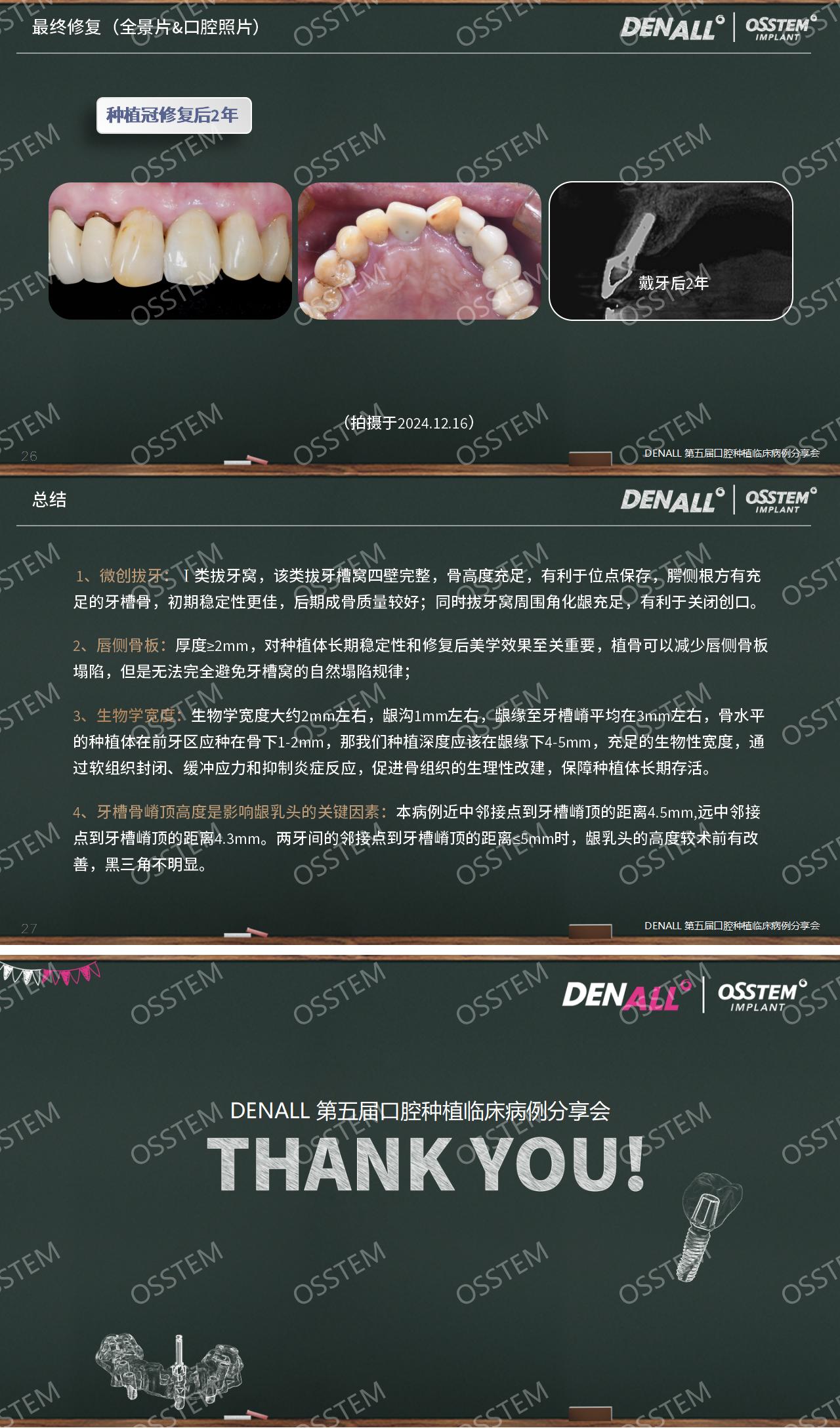 11-上前牙即刻种植的病例解析_02.jpg
